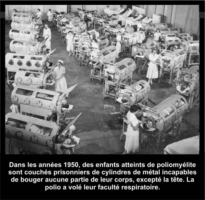 Les vraies causes de la polio ne sont pas relies  un soi-disant virus ou une autre forme de microbe